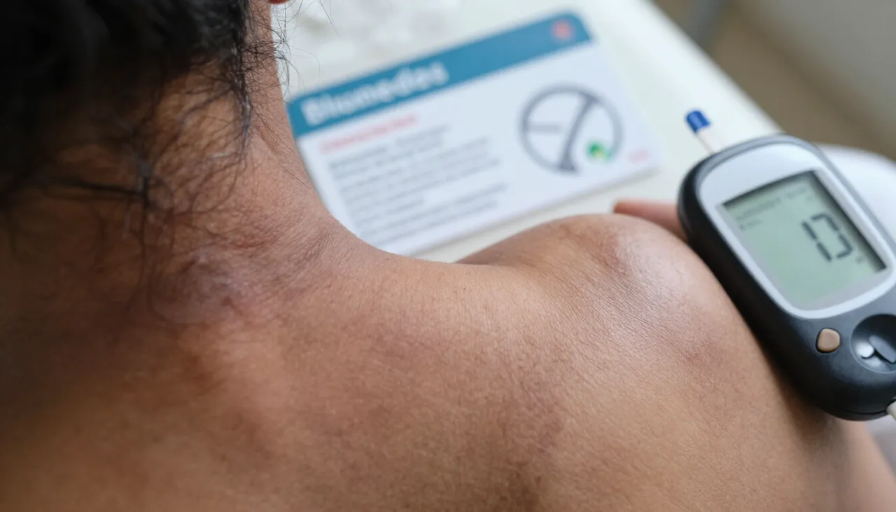 Close-up of darkened velvety skin on the back of the neck beside a diabetes reference card and a glucometer at a Bhubaneswar clinic — Darkening of Skin