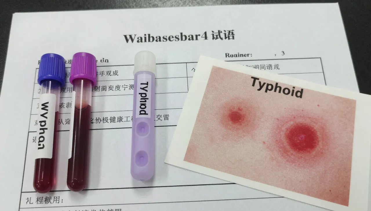 Widal test lab report for typhoid beside blood culture sample tubes and a rose-spot rash reference card at a Bhubaneswar clinic — Typhoid Fever