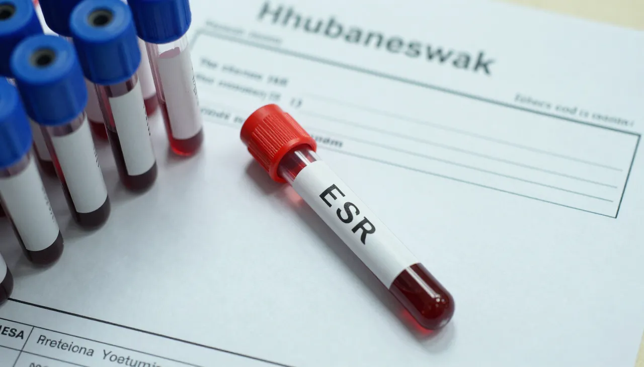 Lab report with a high ESR value circled beside blood sample tubes and an inflammation reference card at a Bhubaneswar clinic — High ESR