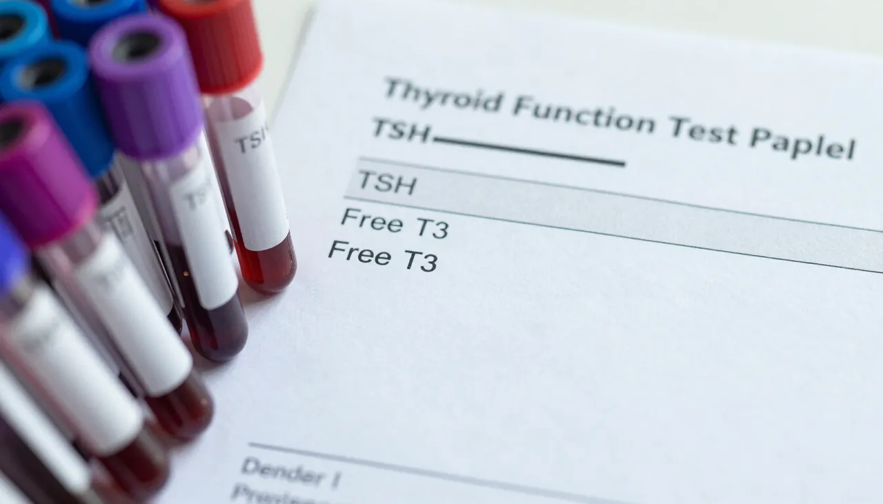 Thyroid function test panel lab report showing TSH, free T3 and free T4 values beside blood sample tubes at a Bhubaneswar clinic — Abnormal Thyroid Function Tests